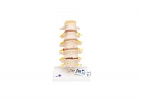 model dydaktyczny osteoporozy - 3b smart anatomy - 1000182 [a95] 3b scientific modele anatomiczne 12